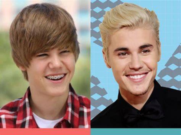 6 Celebrities With Braces Before and After &mdash; Wonderful Transformations