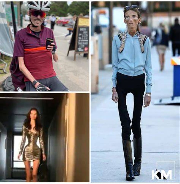 9 skinniest people in the world Tuko.co.ke