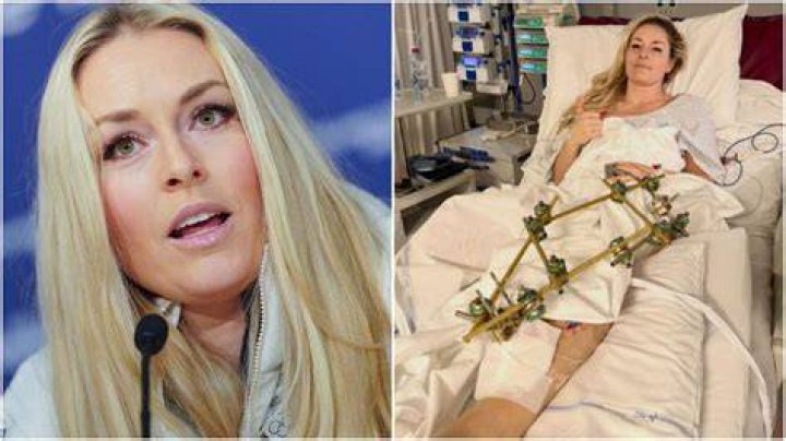 Lindsey Vonn's Question About Interracial Relationships Sparks Some