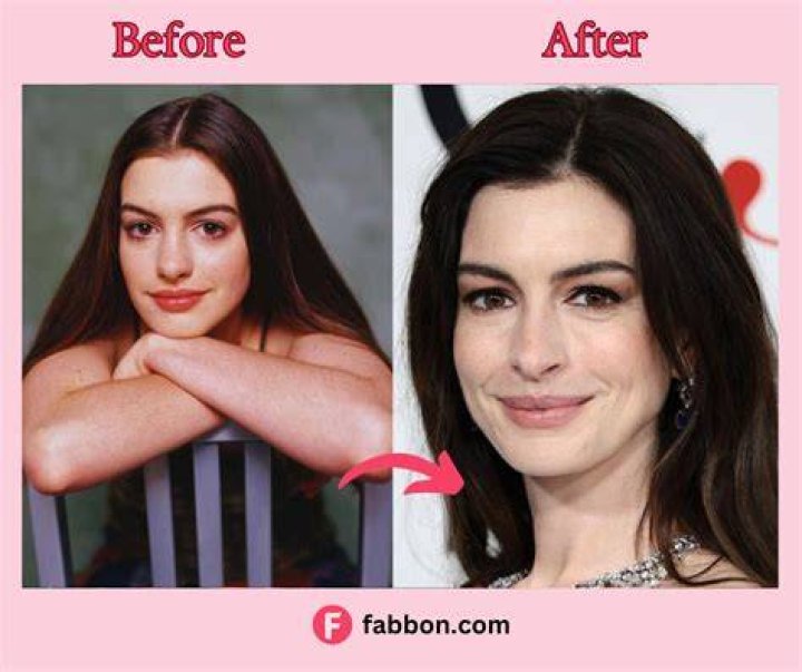 No, Anne Hathaway Is Not A Cannibal Despite That Viral Tweet ELLE